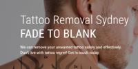 Fade to Blank Tattoo Removals image 1